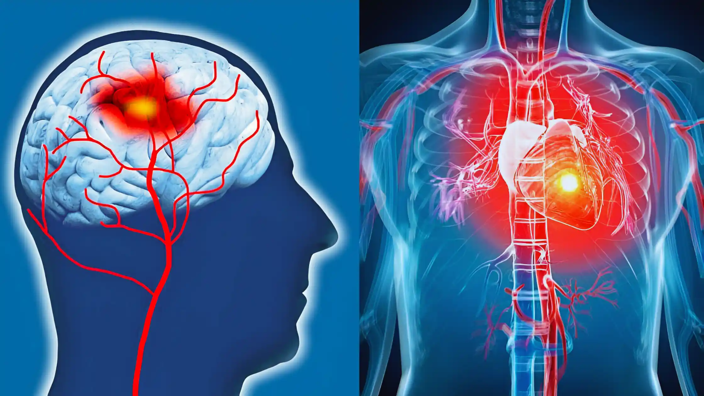 Difference Between Stroke And Heart Attack: A Valuable Guide 1 Difference between Stroke and Heart Attack