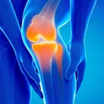 Keep Your Joints Healthy