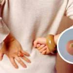 Do Kidney Stones Cause Back Pain