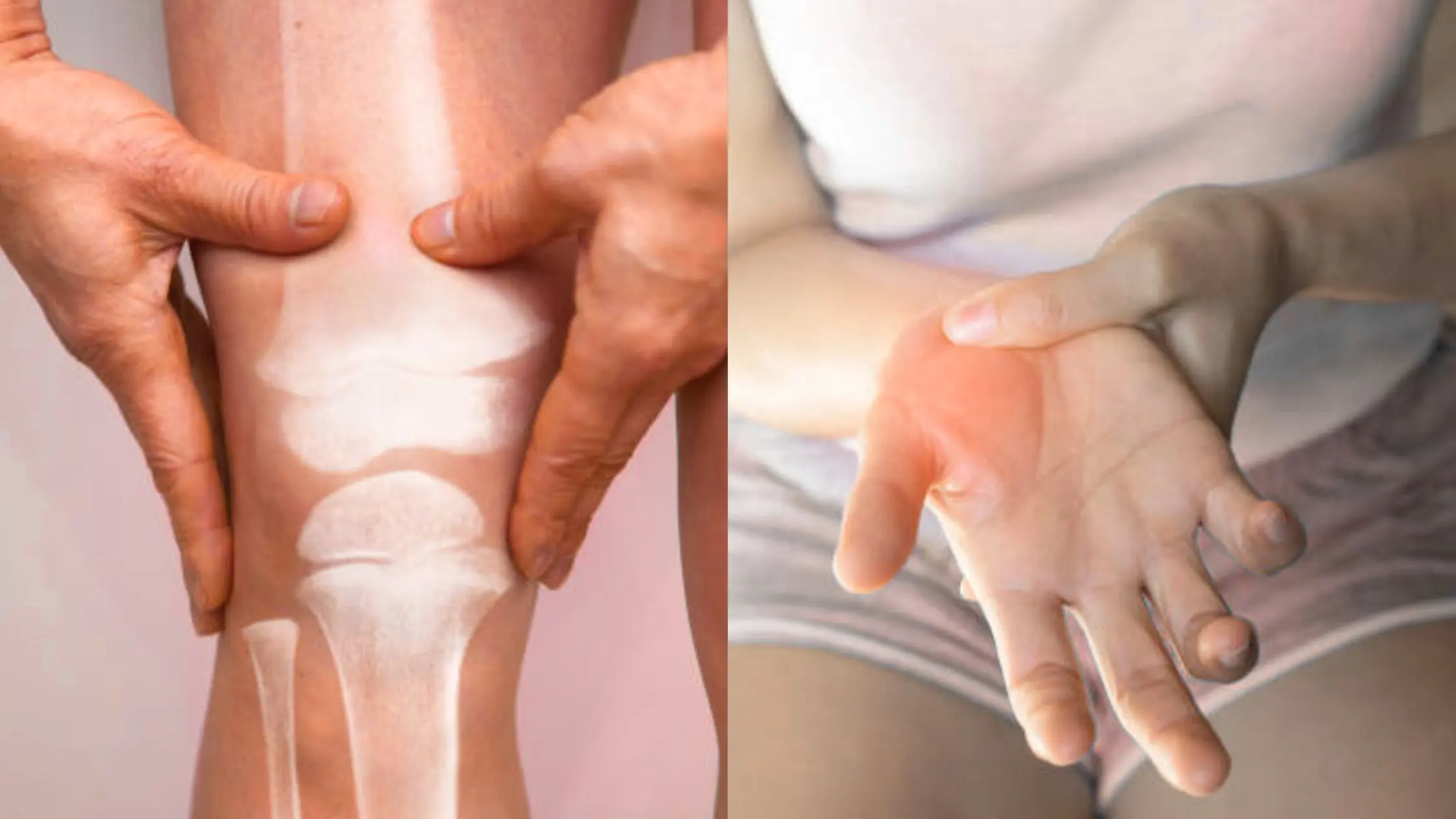 Osteoarthritis vs Rheumatoid Arthritis