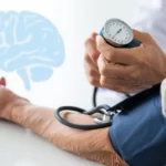 can hypotension cause stroke